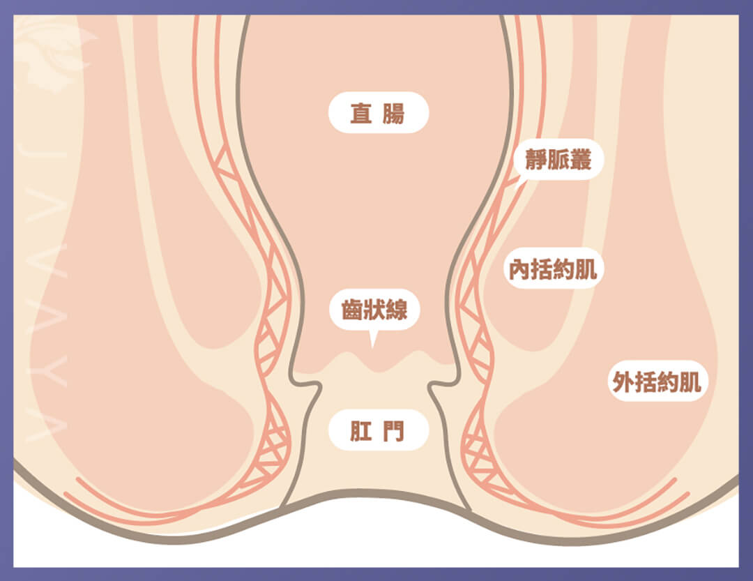 舒眠微創痔瘡手術舒眠微創痔瘡手術-痔瘡是什麼?痔瘡的位置在? | 佳飛雅醫美